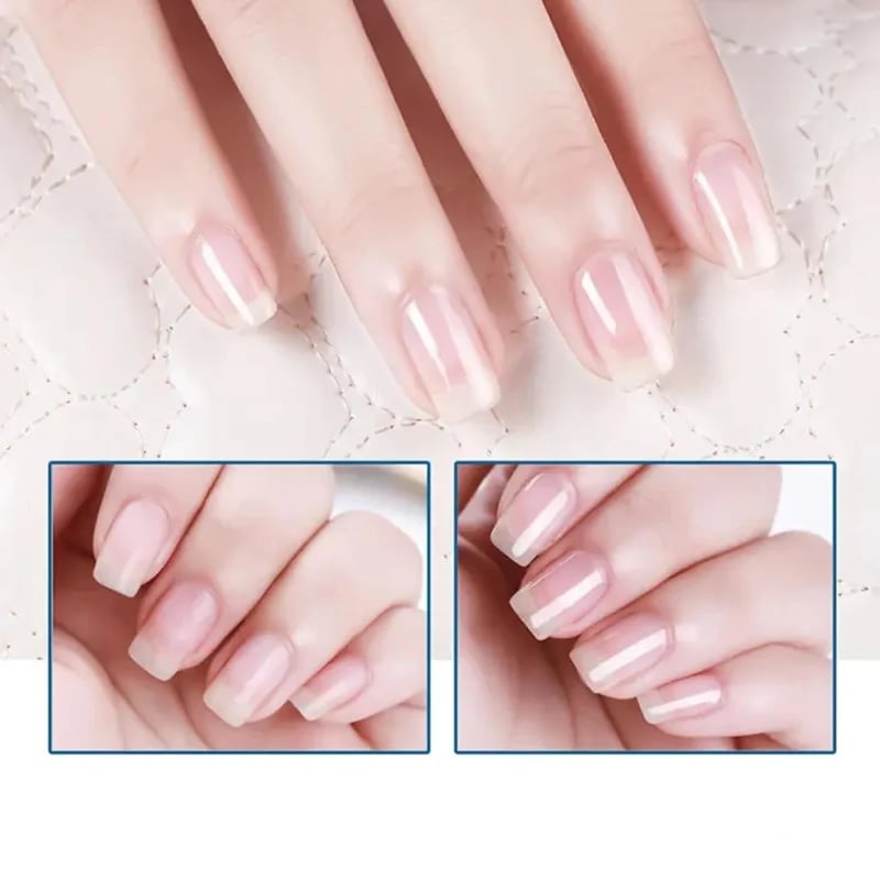 💖💕Limited-Time 50% Off ✨3 Days Gloss & Care Nail Formula