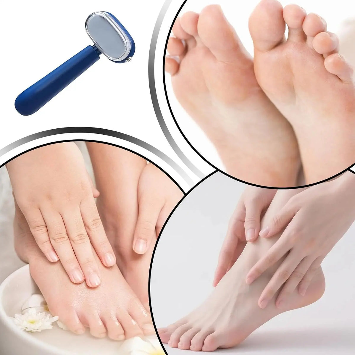 🎁BUY 1 GET 1 FREE🎁 Professional Dual-Sided Foot Callus Remover – Professional Stainless Steel Pedicure Scraper 🦶✨